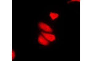 Immunofluorescent analysis of MDA5 staining in THP1 cells.