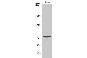 Western Blotting (WB) image for anti-Checkpoint Kinase 2 (CHEK2) (pThr68) antibody (ABIN3179414) (CHEK2 anticorps  (pThr68))