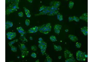 Image no. 9 for anti-ATP Synthase, H+ Transporting, Mitochondrial F1 Complex, beta Polypeptide (ATP5B) antibody (ABIN1496769)