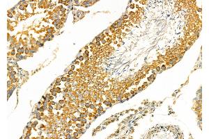 ABIN6266241 and ABIN6277393 at 1/100 staining Rat testis tissue by IHC-P. (Kallikrein 2 anticorps  (Internal Region))