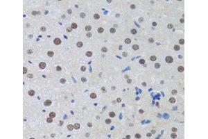 Immunohistochemistry of paraffin-embedded Rat liver using MTA3 Polyclonal Antibody at dilution of 1:100 (40x lens). (MTA3 anticorps)