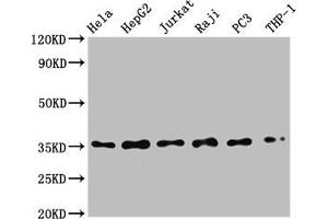 Western Blot Positive WB detected in: Hela whole cell lysate, HepG2 whole cell lysate, Jurkat whole cell lysate, Raji whole cell lysate, PC3 whole cell lysate, THP-1 whole cell lysate All lanes: NFKBIA antibody at 0.