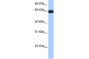 WB Suggested Anti-ARHGAP28 Antibody Titration: 0. (ARHGAP28 anticorps  (C-Term))