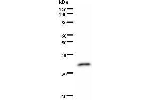 Western Blotting (WB) image for anti-Thyroid Hormone Receptor, alpha (THRA) antibody (ABIN931176) (THRA anticorps)