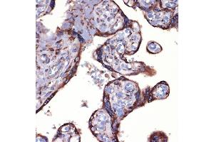 Immunohistochemistry of paraffin-embedded human placenta using Peroxiredoxin 4 (PRDX4) (PRDX4) Rabbit mAb (ABIN7269238) at dilution of 1:100 (40x lens).