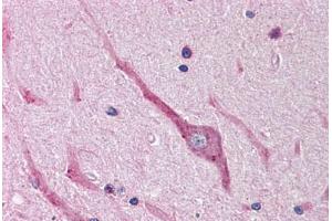 Human Brain, Cerebellum (formalin-fixed, paraffin-embedded) stained with SNAI2 antibody ABIN214479 at 2. (SLUG anticorps  (Internal Region))