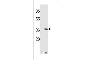Western blot analysis of IL1A (arrow) using rabbit polyclonal IL1A-pS87 (ABIN390844 and ABIN2841070). (IL1A anticorps  (AA 65-94))