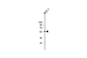 Anti-CYP27B1 Antibody (C-term) at 1:1000 dilution + MCF-7 whole cell lysate Lysates/proteins at 20 μg per lane.