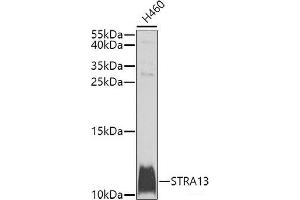 Western blot analysis of extracts of H460 cells using STRA13 Polyclonal Antibody at dilution of 1:1000. (STRA13 anticorps)