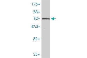 Western Blot detection against Immunogen (61.