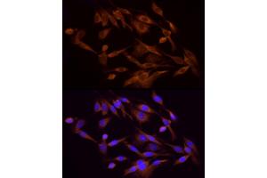 Immunofluorescence analysis of PC-12 cells using PI3 Kinase p85 alpha Rabbit pAb (ABIN6130616, ABIN6145641, ABIN6145644 and ABIN6215094) at dilution of 1:100 (40x lens). (PIK3R1 anticorps)