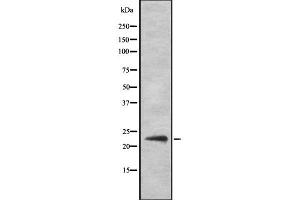 Western blot analysis of SOCS2 Antibody expression in Hela cells lysates.