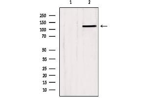 Western blot analysis of extracts from Hela, using SLC24A1 Antibody. (SLC24A1 anticorps  (N-Term))