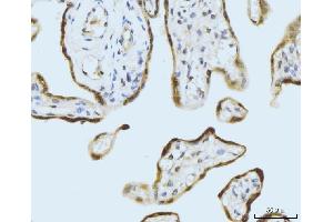 IHC analysis of SBNO1 using anti-SBNO1 antibody (ABIN7601710). (SBNO1 anticorps  (AA 43-1303))