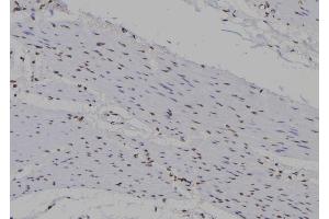 ABIN6277272 at 1/100 staining Human gastric tissue by IHC-P.