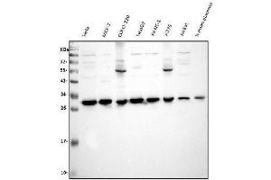 Western blot analysis of VAPB using anti-VAPB antibody (ABIN5693292). (VAPB anticorps  (AA 2-55))