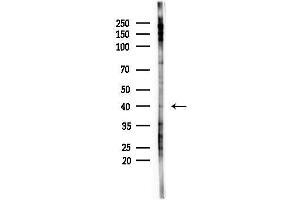 Western blot analysis of lysates from F10-LUC cells(LPS,4h treatment), using GN Antibody at 1/1000 dilution.