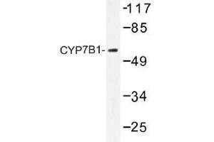 Image no. 1 for anti-Cytochrome P450, Family 7, Subfamily B, Polypeptide 1 (CYP7B1) antibody (ABIN317809) (CYP7B1 anticorps)
