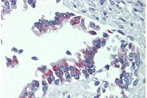 Human Lung, respiratory epithelium: Formalin-Fixed, Paraffin-Embedded (FFPE)