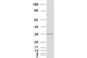 Validation with Western Blot