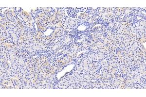 Detection of SERPINB3 in Human Kidney Tissue using Polyclonal Antibody to Serpin B3 (SERPINB3)