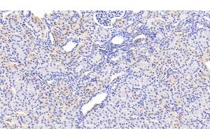 Detection of SERPINB3 in Human Kidney Tissue using Polyclonal Antibody to Serpin B3 (SERPINB3) (SERPINB3 anticorps  (AA 1-210))