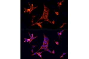 Immunofluorescence analysis of NIH/3T3 cells using MTAP Rabbit mAb (ABIN7268498) at dilution of 1:100 (40x lens). (MTAP anticorps)
