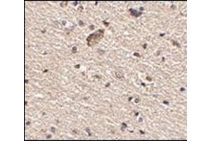 Immunohistochemistry of Spred1 in human brain tissue with this product at 2. (SPRED1 anticorps  (Center))
