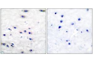 Immunohistochemical analysis of paraffin-embedded human brain tissue using Tyrosine Hydroxylase (epitope around residue 19) antibody (ABIN5976157).