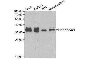Western blot analysis of extracts of various cell lines, using HNRNPA2B1 antibody. (HNRNPA2B1 anticorps  (AA 1-180))