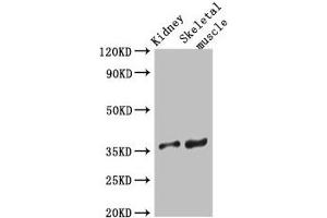 Western Blot Positive WB detected in: Mouse kidney tissue, Mouse skeletal muscle tissue All lanes: SLC25A32 antibody at 3 μg/mL Secondary Goat polyclonal to rabbit IgG at 1/50000 dilution Predicted band size: 36 kDa Observed band size: 36 kDa (SLC25A32 anticorps  (AA 44-88))