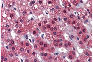 Human Adrenal: Formalin-Fixed, Paraffin-Embedded (FFPE) (Calcyphosine 2 anticorps  (Internal Region))