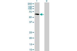 Western Blot analysis of GALNTL1 expression in transfected 293T cell line ( H00057452-T01 ) by GALNTL1 MaxPab polyclonal antibody. (GALNTL1 anticorps  (AA 1-558))