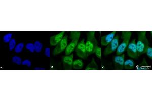 Immunocytochemistry/Immunofluorescence analysis using Rabbit Anti-Phosphothreonine Polyclonal Antibody . (Phosphothreonine anticorps  (FITC))