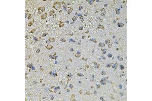 Immunohistochemistry of paraffin-embedded mouse brain using CREBBP antibody (ABIN5974440) at dilution of 1/100 (40x lens). (CBP anticorps)