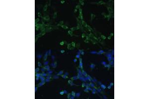 Immunofluorescence analysis of NIH-3T3 cells using eEF1G Polyclonal Antibody (ABIN6133514, ABIN6139951, ABIN6139952 and ABIN6223877) at dilution of 1:100 (40x lens). (EEF1G anticorps  (AA 168-437))