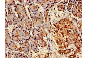 Immunohistochemistry of paraffin-embedded human pancreatic tissue using ABIN7144793 at dilution of 1:100 (Ataxin 3 anticorps  (AA 1-288))