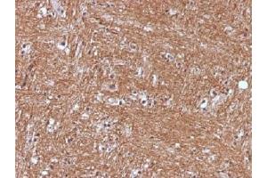 IHC testing of FFPE human cerebellum with NSE antibody (clone ENO2/1375). (ENO2/NSE anticorps  (AA 416-433))