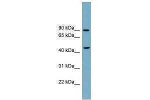 SMPD2 antibody used at 1 ug/ml to detect target protein. (SMPD2 anticorps)
