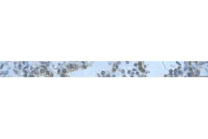 Rabbit Anti-RBM8A Antibody       Paraffin Embedded Tissue:  Human alveolar cell   Cellular Data:  Epithelial cells of renal tubule  Antibody Concentration:   4.