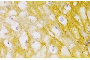 Immunohistochemistry of paraffin-embedded Human esophagus using ACTN1 Polyclonal Antibody at dilution of 1:100 (40x lens). (ACTN1 anticorps)