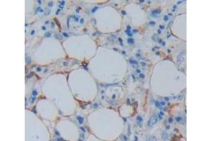 IHC-P analysis of Human Tissue, with DAB staining. (MYH7B anticorps  (AA 829-1106))
