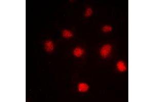 Immunofluorescent analysis of Histone H4 (AcK5) staining in HeLa cells.