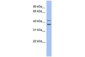 WB Suggested Anti-SERPINB2 Antibody Titration: 0.