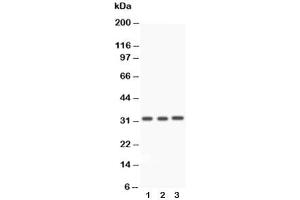 Western blot testing of Caspase-3 antibody and Lane 1:  rat liver