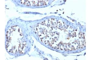 Formalin-fixed, paraffin-embedded human Testicular Carcinoma stained with B7-H4 Mouse Monoclonal Antibody (B7H4/1788). (VTCN1 anticorps)