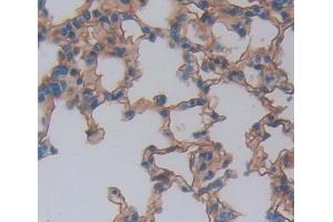 Used in DAB staining on fromalin fixed paraffin- embedded lung tissue (NCR1 anticorps  (AA 17-258))