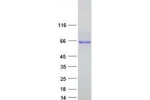 Validation with Western Blot