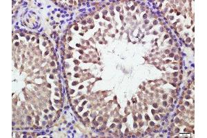 anti-ATG16 Autophagy Related 16-Like 1 (ATG16L1) (AA 501-607) antibody