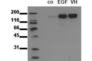 Western Blotting (WB) image for anti-Epidermal Growth Factor Receptor (EGFR) (pTyr1092) antibody (ABIN126770) (EGFR anticorps  (pTyr1092))